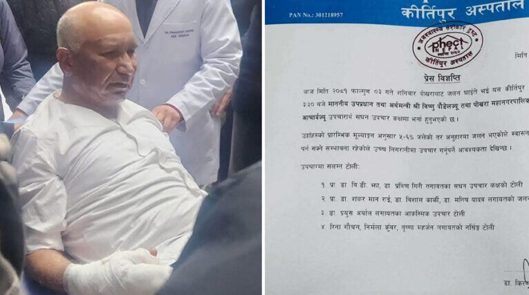 अर्थमन्त्री र मेयरको श्वासनली र फोक्सोमा असर पर्न सक्ने सम्भावना, ६ प्रतिशत शरीर जल्यो